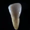 Pardontitis/Pardentose